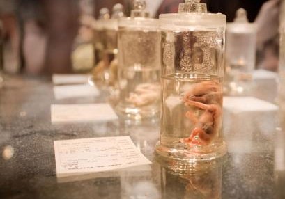 台州染色体异常夫妻海南试管，三代PGT-SR技术，优生优育方案