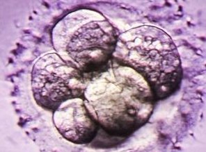 上海三代试管费用是多少？试管婴儿价格是多少？